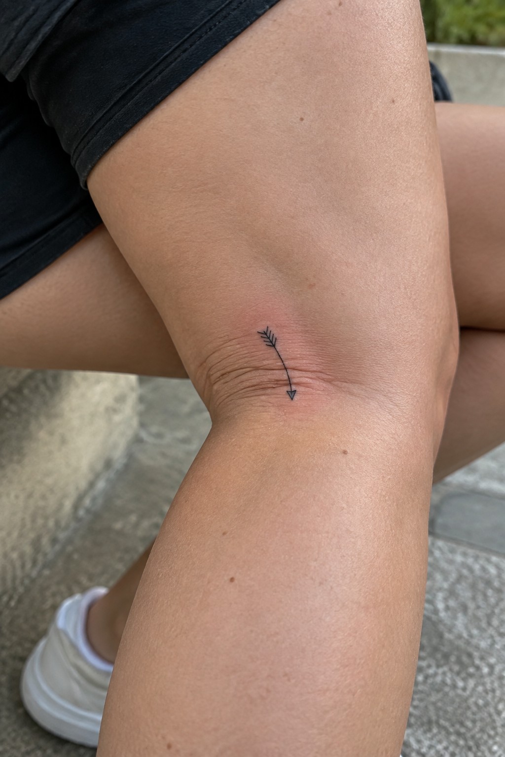 Small black arrow tattoo on reddened knee skin below black shorts.
